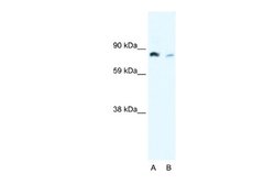 NFkB p100/p52 Antibody, Novus Biologicals 100 &mu;L; Unconjugated:Antibodies,